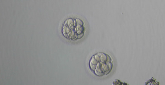 Almacenamiento de embriones Posición FECOLSOG